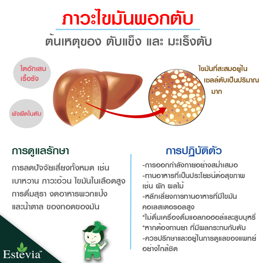 ภาวะไขมันพอกตับ